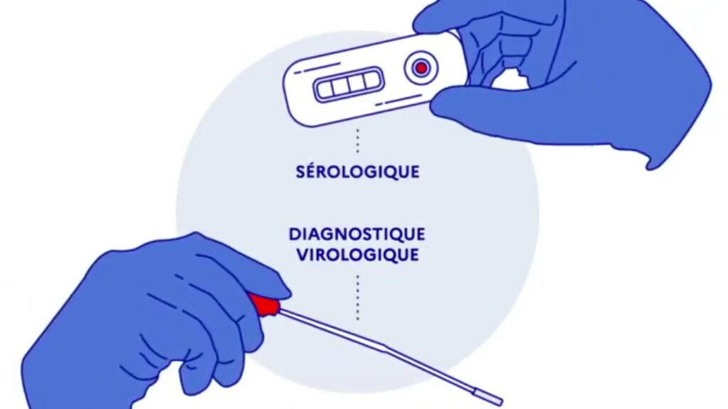 Serologique-PCR-infographie