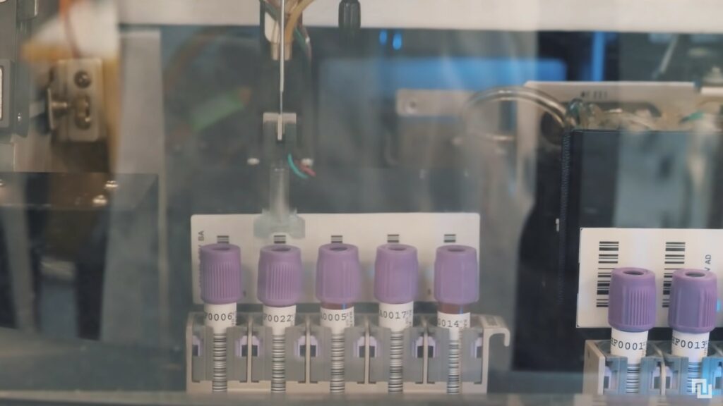 Le nombre de personnes infectées par le coronavirus est sous-estimé, mais à quel point ?