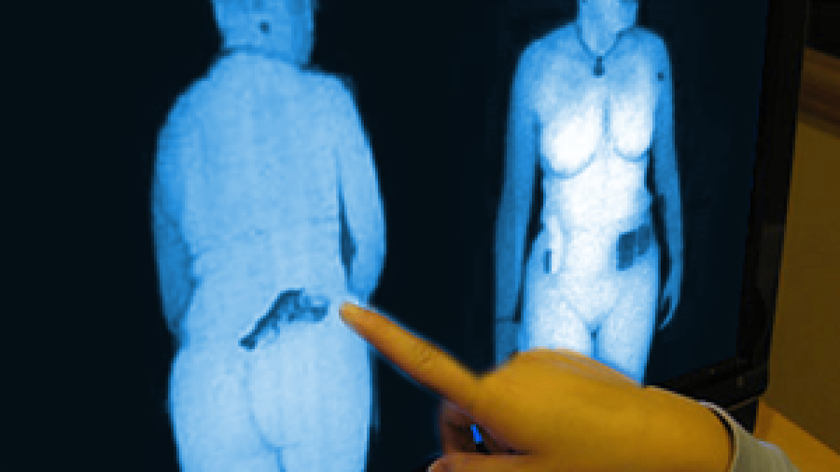 scanner-corporel.png