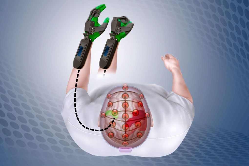 Des dispositifs de contrôle de prothèses par les signaux cérébraux existent déjà. // Source : Matthew Holt/Sara Moser