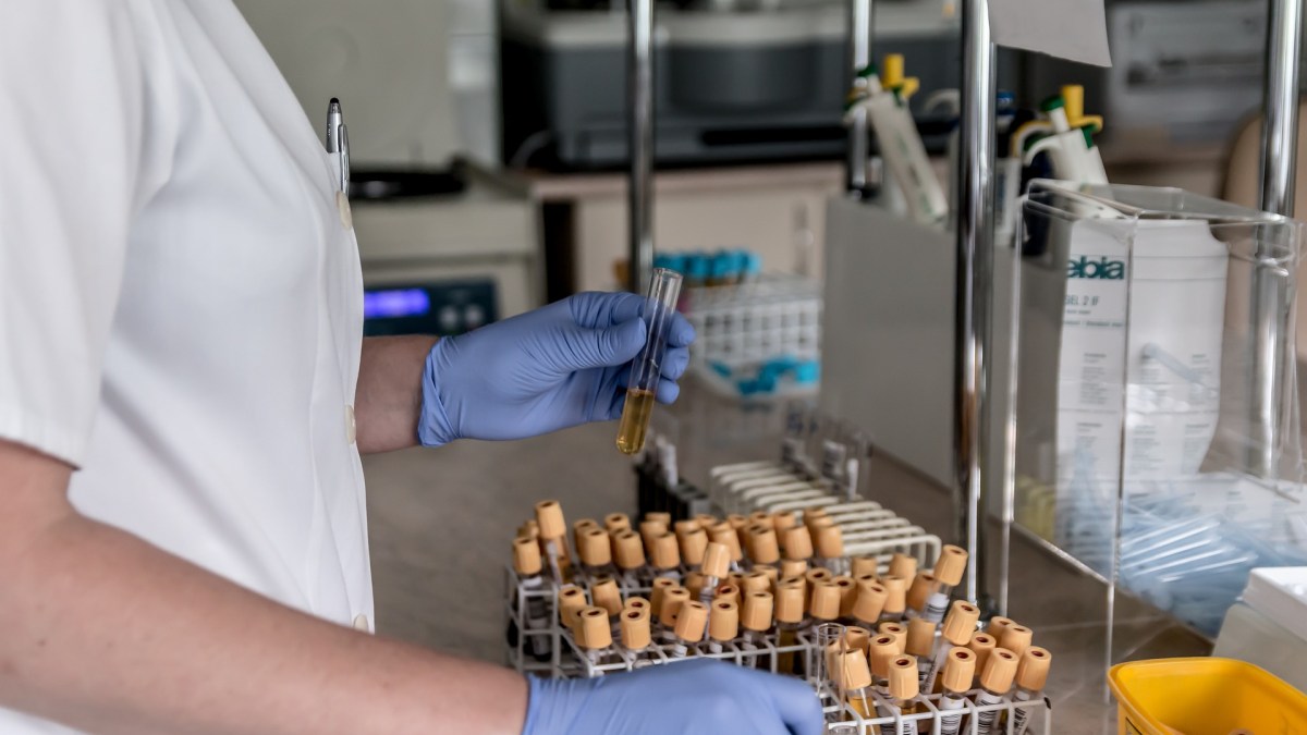 santé laboratoire médecine cancer