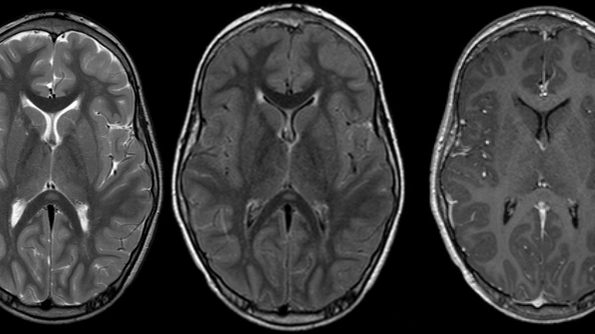 mri