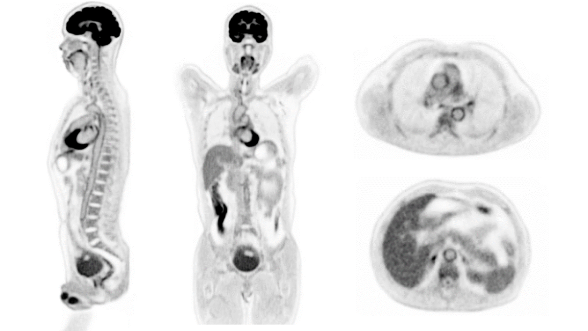 Détails de la première image prise par le scanner Explorer. // Source : UC Davis / Explorer