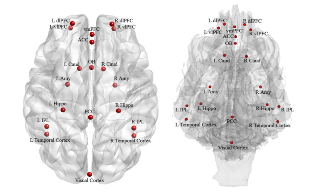 Les zones du cerveau activées dans le cerveau des chiens, comparées à celles des humains. // Source : Thompkins, A.M., Ramaiahgari, B., Zhao, S. et al. Learn Behav