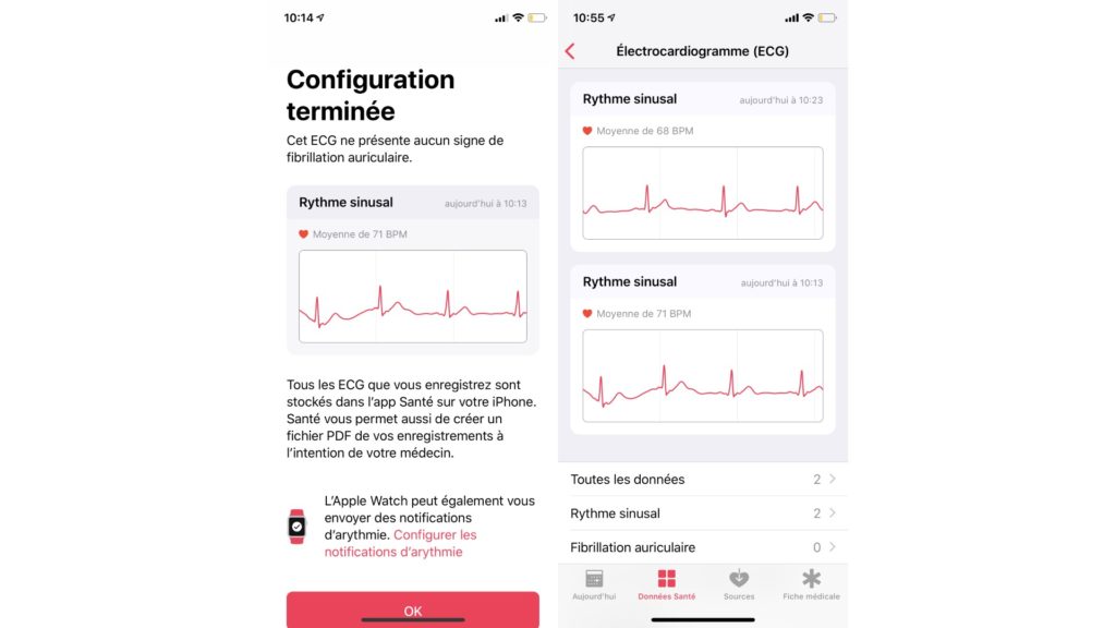 Résultats des électrocardiogrammes sur Apple Watch (application Santé) // Source : Numerama