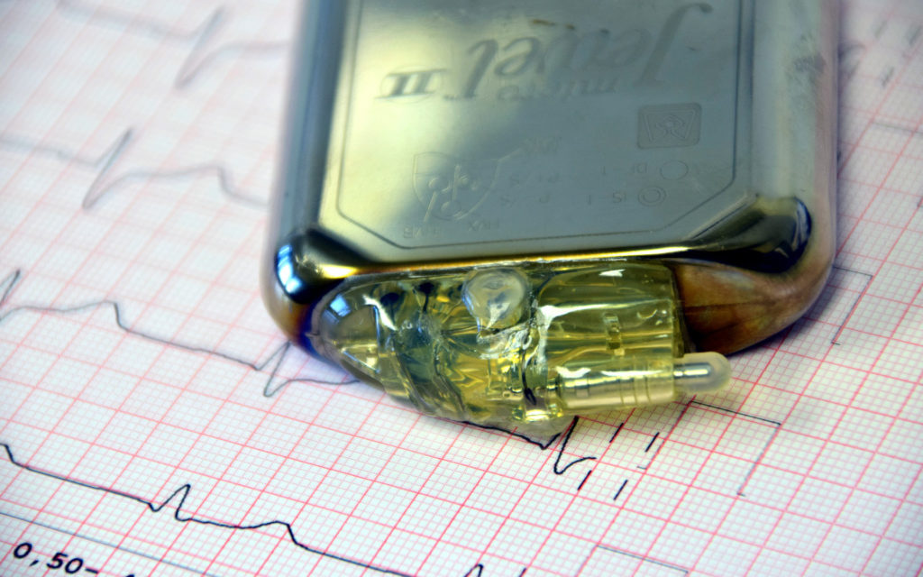 Un stimulateur cardiaque. // Source : Pixabay (photo recadrée)