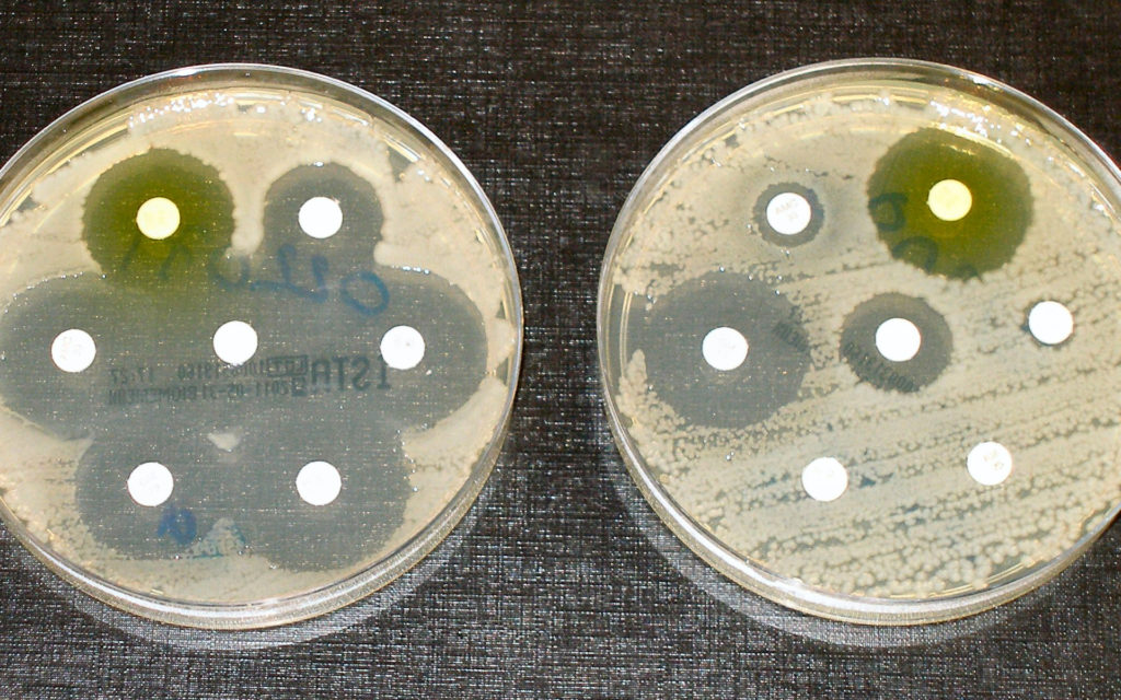 Des tests de résistance aux antibiotiques. // Source : Wikimedia/CC/Dr Graham Beards (photo recadrée)