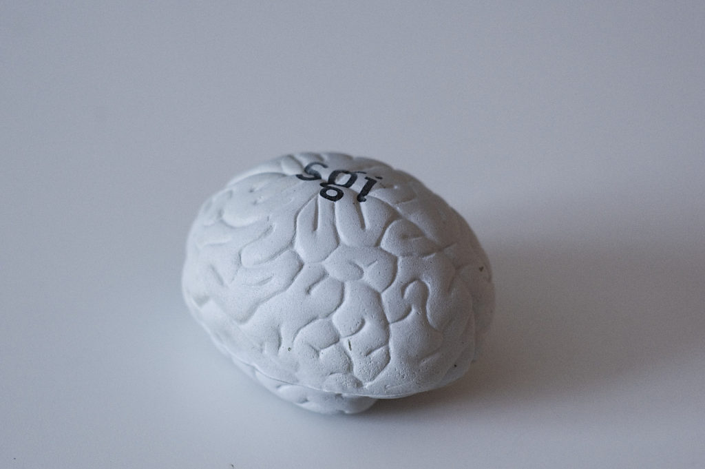 Une reproduction d'un cerveau. // Source : Flickr/CC/Anton Lindström