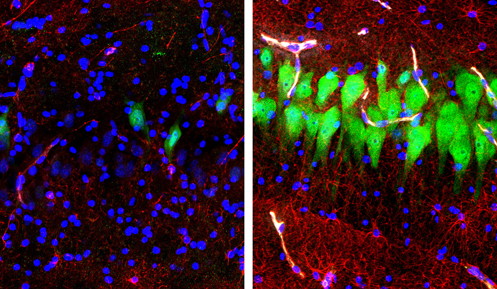 À gauche, un cerveau non traité 10 heures après le décès. À droite, le cerveau traité par les neuroscientifiques. // Source : Stefano G. Daniele & Zvonimir Vrselja; Sestan Laboratory; Yale School of Medicine