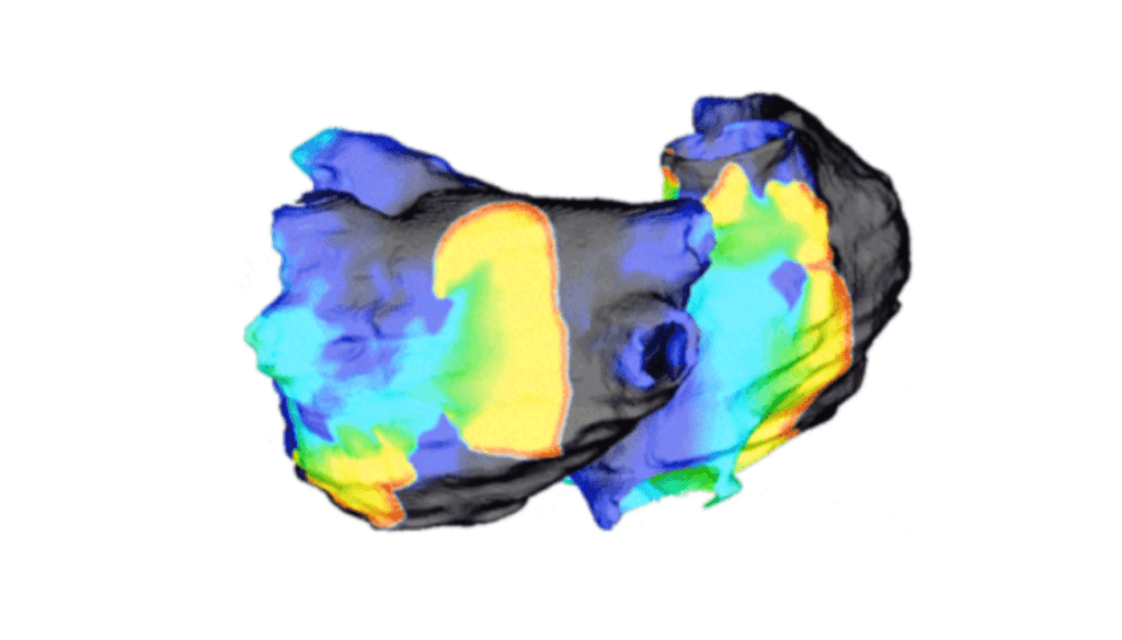 Dans la technique OPTIMA, le coeur humain est modélisé virtuellement en 3D. // Source : Patrick M. Boyle and Natalia A. Trayanova