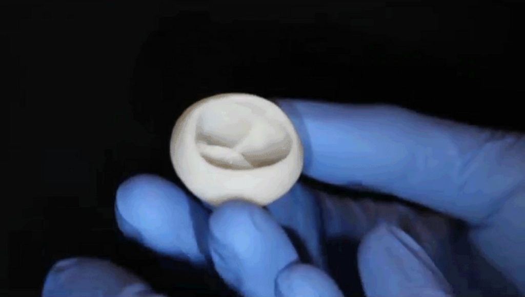 Impression 3D en santé : l'avancée du coeur en bio-impression 3D