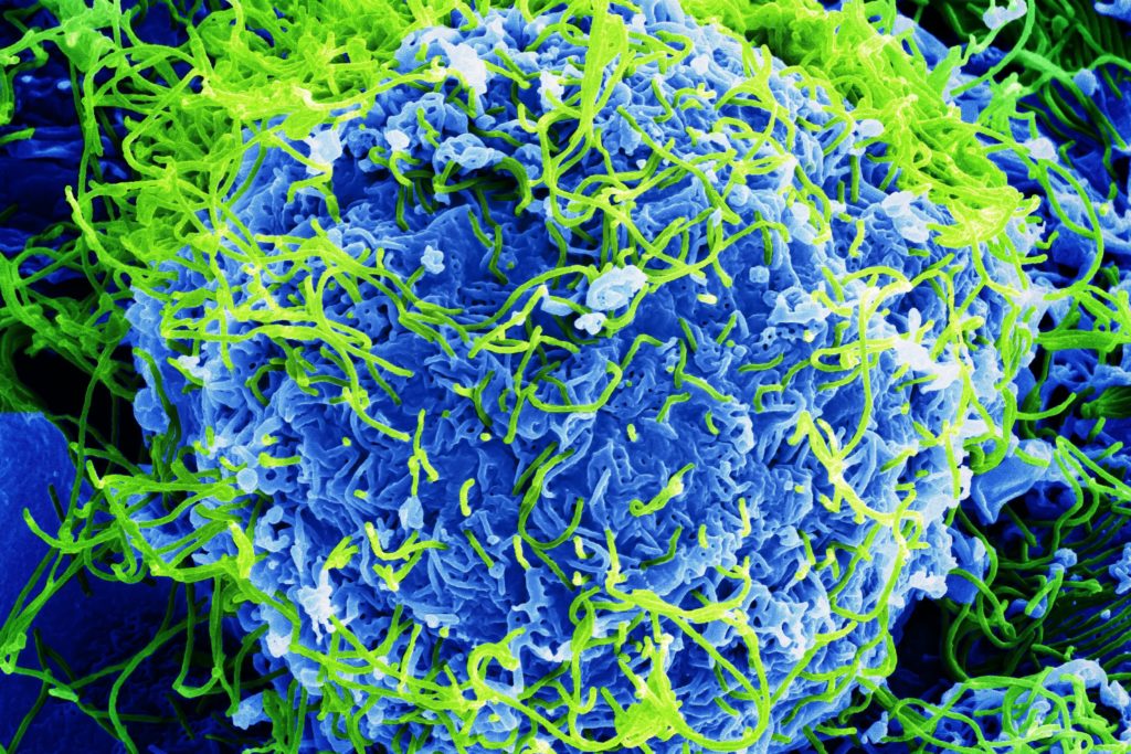 Le virus Ebola au microscope électronique, avec un grossissement de 20 000. // Source : BernbaumJG