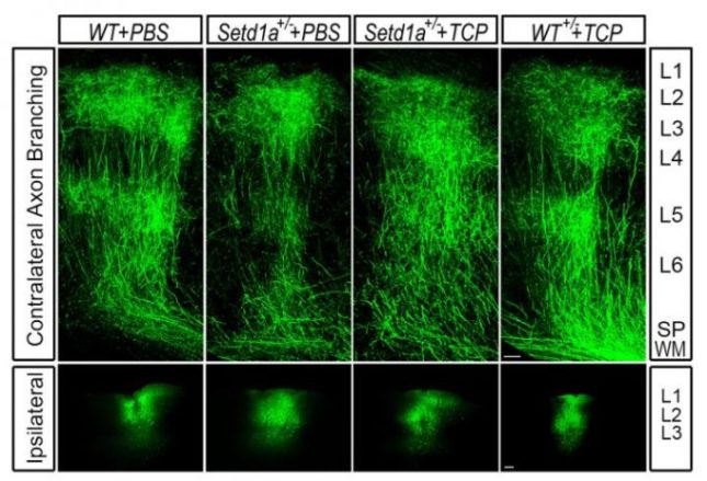 Représentation des axones des souris où le traitement a été expérimenté. // Source : Jun Mukai/Gogos lab/Columbia's Zuckerman Institute