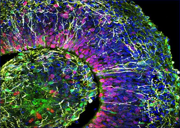 Une vue au sein du réseau neuronal d'un mini-cerveau. // Source : Muotri Lab/UC San Diego