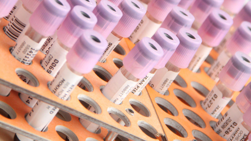 Échantillons en laboratoire. // Source : Pixabay (photo recadrée) Échantillons en laboratoire. // Source : Pixabay (photo recadrée)