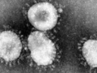 Image d'un coronavirus (ici celui qui provoque le Syndrome respiratoire aigu sévère). Le terme signifie « virus à couronne », car le virus est entouré d'une petit couronne de projections bulbeuses comme on peut le voir sur cette image au microscope. // Source : CDC 