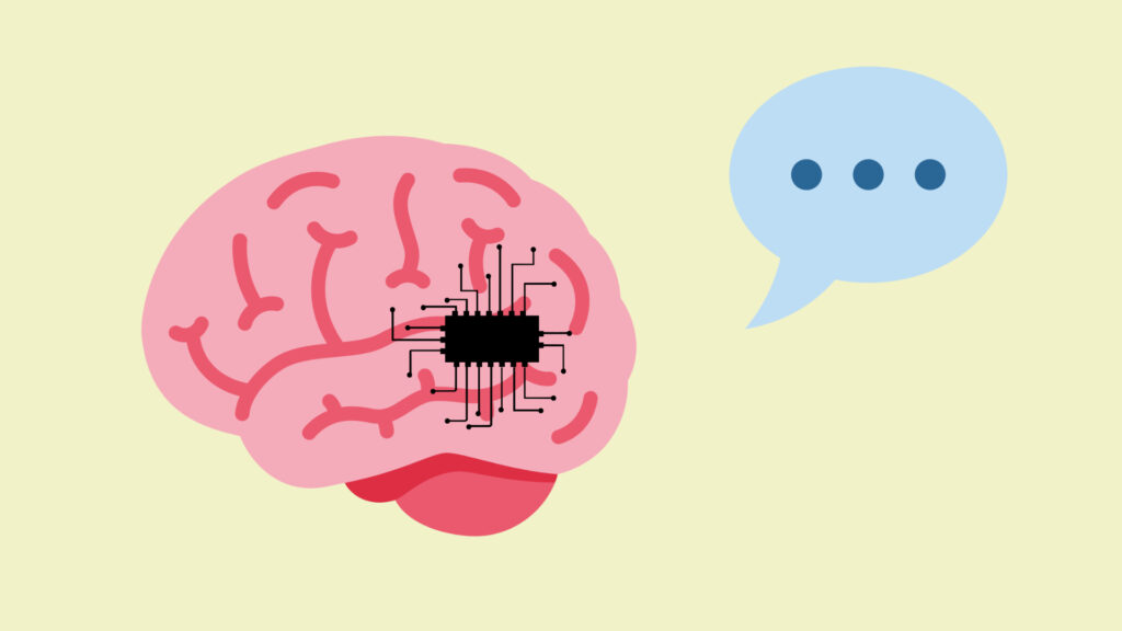 An AI would help decode thoughts into words via an implant.  // Source: Wikimedia/CC/Twitter, SVG Silh (Numerama montage)
