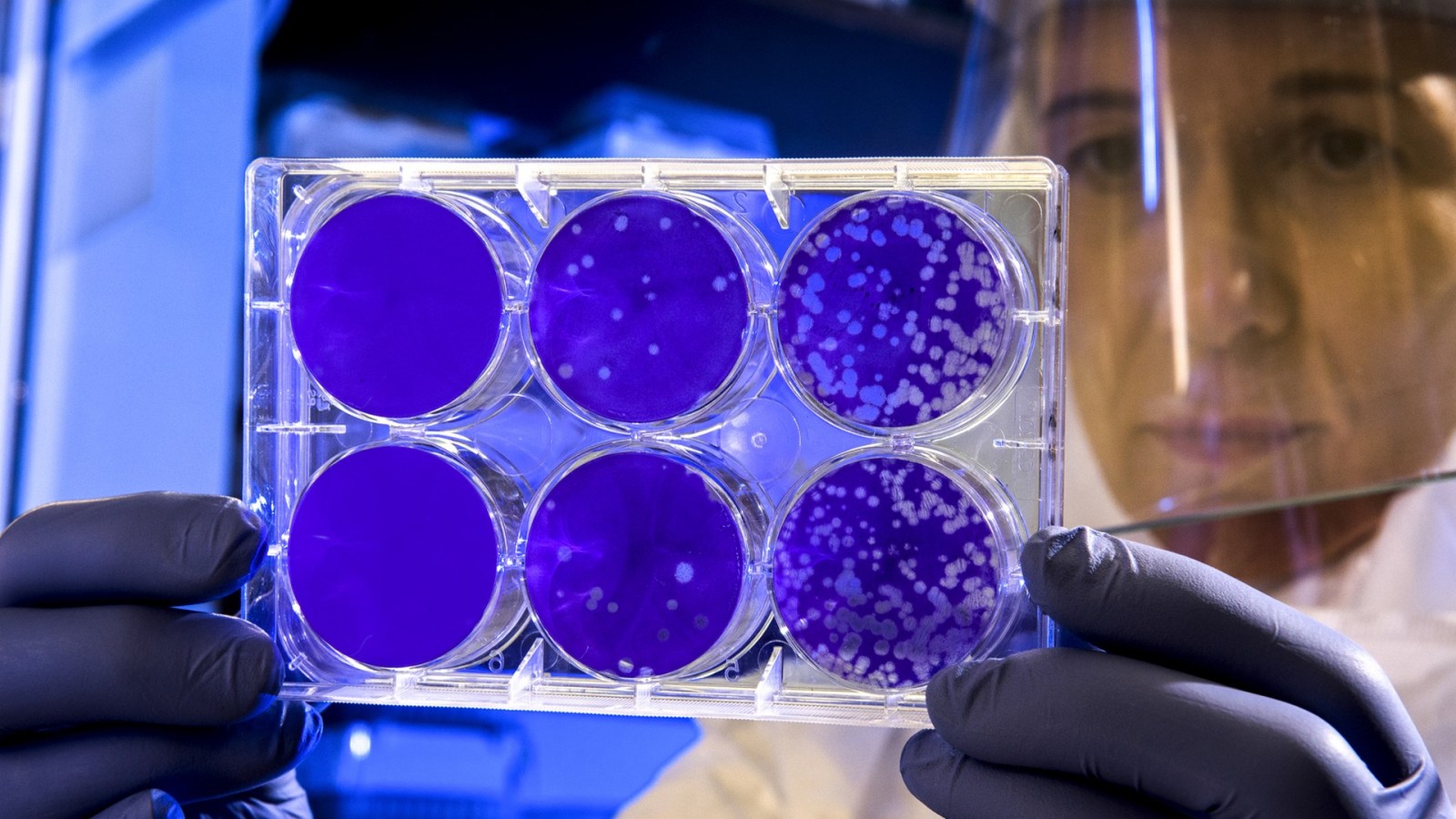 Tout comprendre aux mutations du coronavirus sars-cov-2 en 5 questions