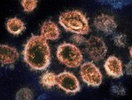 Le Coronavirus SARS-CoV-2 (souche originelle) vu par microscope électronique en transmission. // Source : NIAID-RML