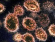 Le Coronavirus SARS-CoV-2 (souche originelle) vu par microscope électronique en transmission. // Source : NIAID-RML