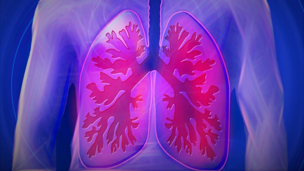 Covid-19 est une pneumonie : elle s'attaque essentiellement aux poumons dans un premier temps. // Source : Pixabay