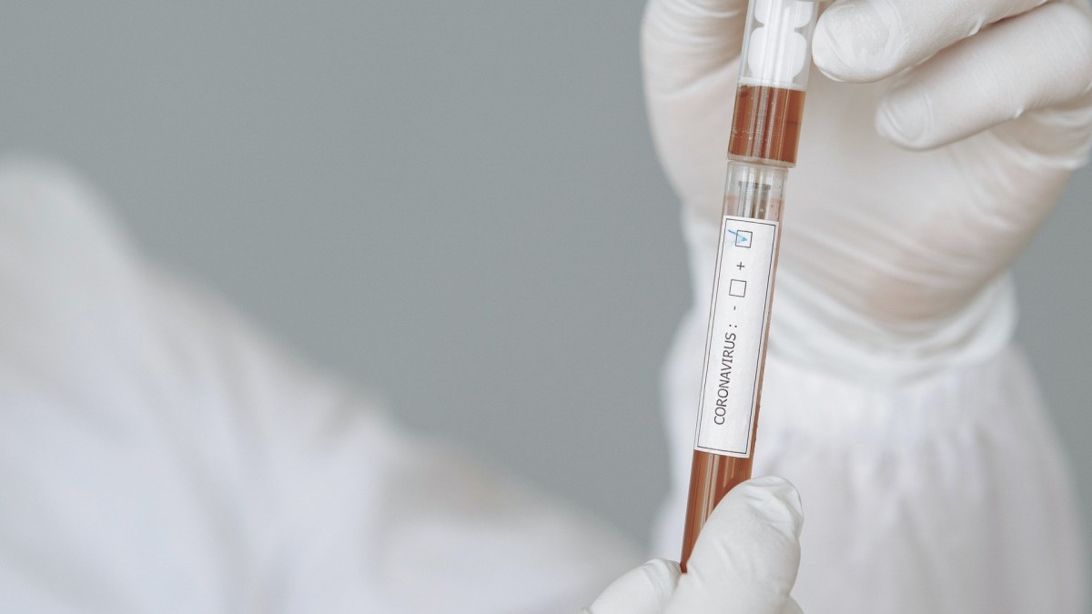 Coronavirus. Maladie Covid-19. // Source : Pexels