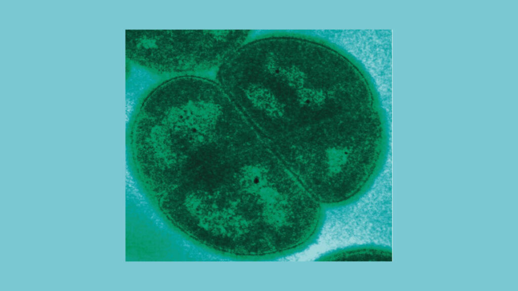 Deinococcus radiodurans. // Source : Wikimedia/TEM of D. radiodurans acquired in the laboratory of Michael Daly, Uniformed Services University, Bethesda, MD, USA.
