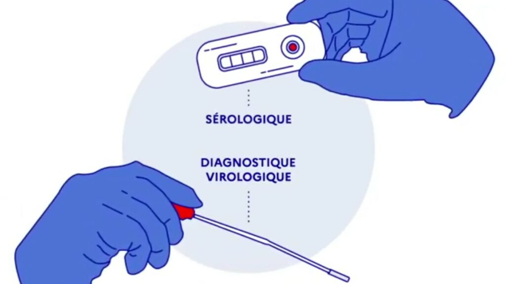 Le test PCR est un prélèvement nasal, et le test antigénique également. // Source : Gouvernement