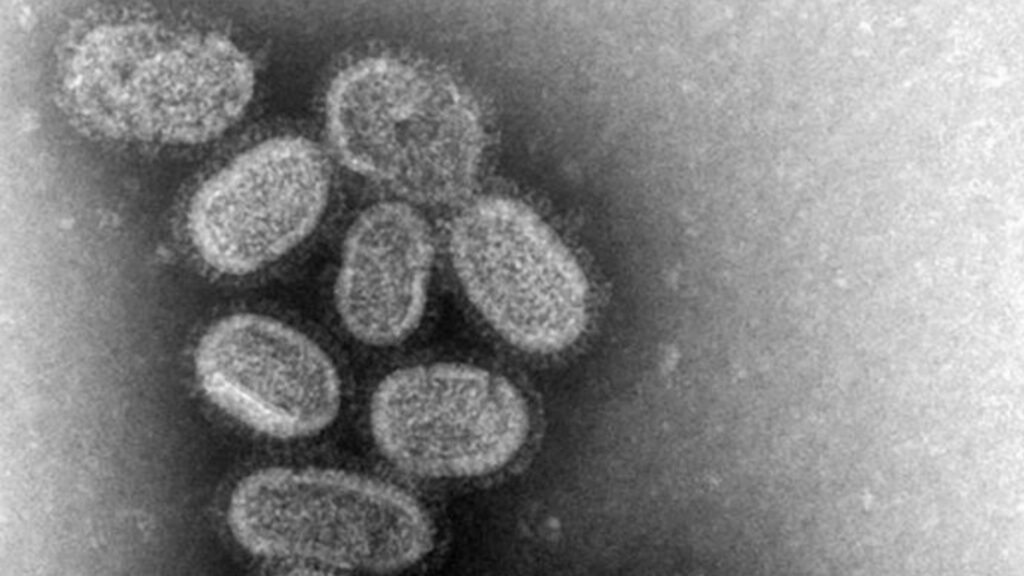 Virus de la grippe. // Source : CDC