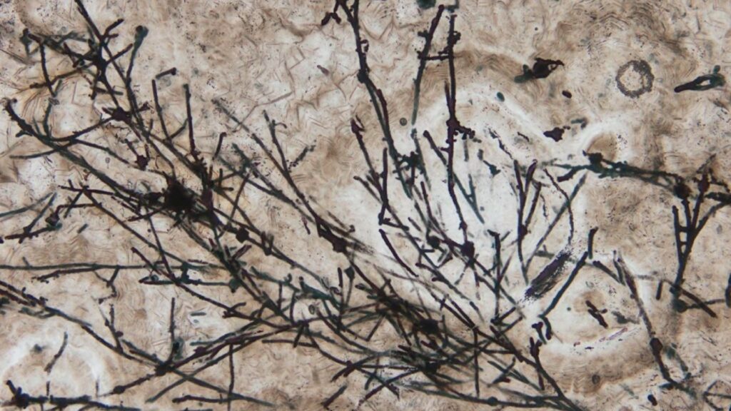 Image au microscope du champignon. // Source : Andrew Czaja of University of Cincinnati.