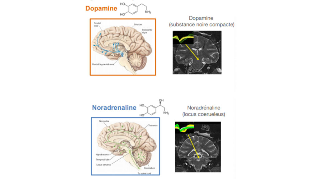 Dopamine et Noradrénaline. // Source : Sébastien Bouret