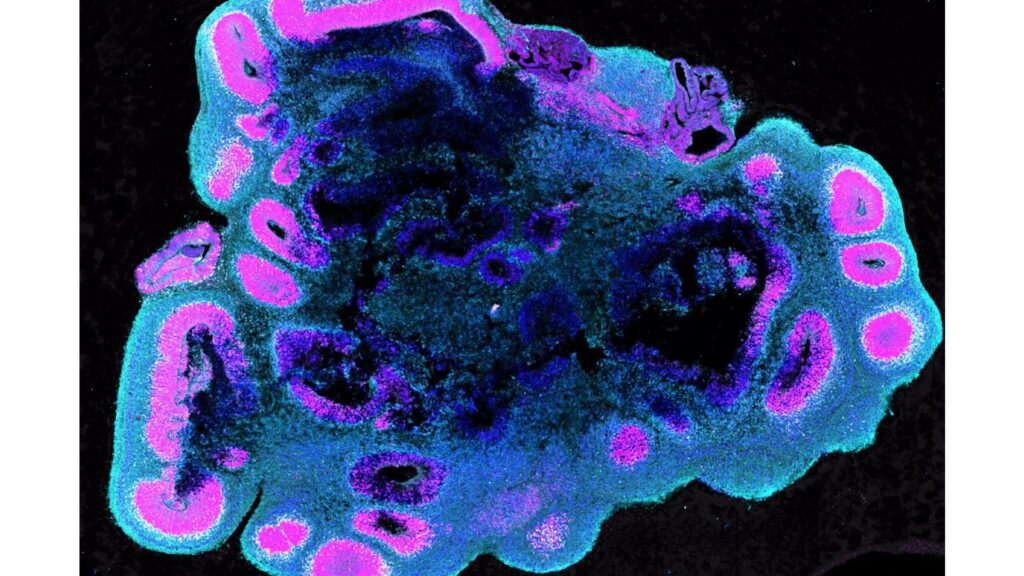 Organoïde humain, modèle des tissus cérébraux. // Source : S.Benito-Kwiecinski/MRC LMB/Cell