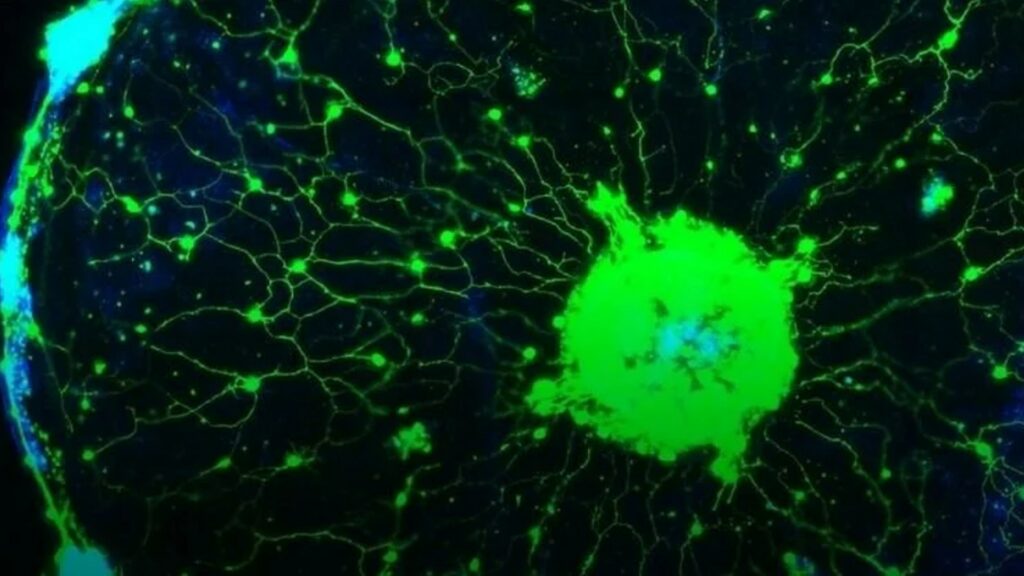 Le réseau de neurones de ces méduses, au microscope, après modification génétique permettant de rendre fluo les neurones activés. // Source : Cell, 2021