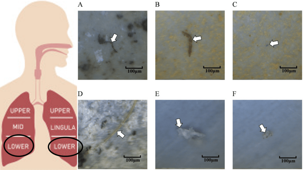 Les particules microplastiques se frayent un chemin jusqu'à la région inférieure des poumons (« lower »). // Source : Jenner et al., Science of the Total Environment, 2022