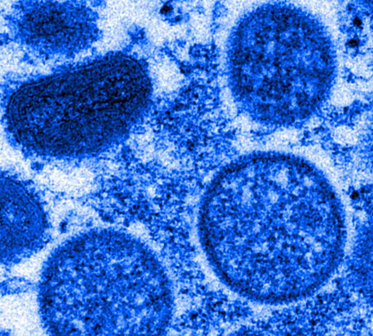 Micrographie électronique de particules de virus de la variole du singe isolés en 2003 aux États-Unis, dans des échantillons humains  // Source : The Conversation / Cynthia S. Goldsmith, Russell Regner / CDC / AP