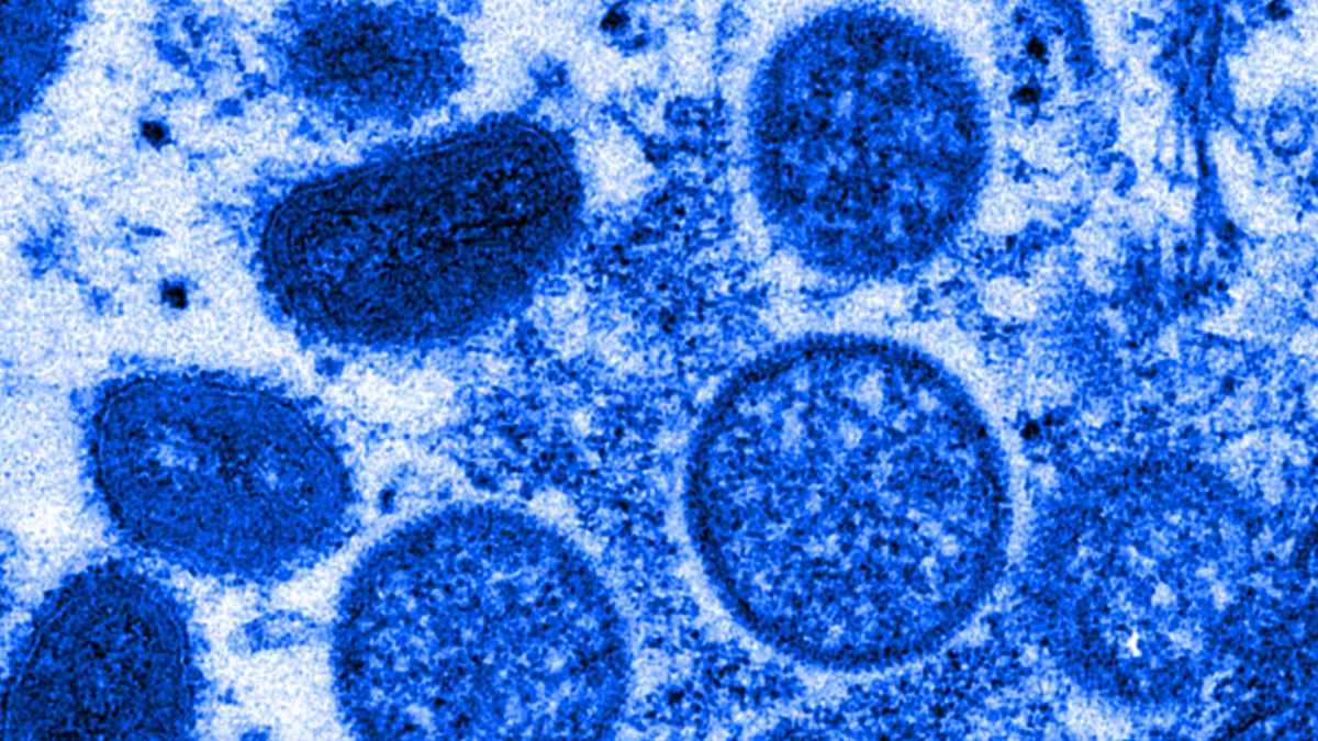 Micrographie électronique de particules de virus de la variole du singe isolés en 2003 aux États-Unis, dans des échantillons humains  // Source : The Conversation / Cynthia S. Goldsmith, Russell Regner / CDC / AP