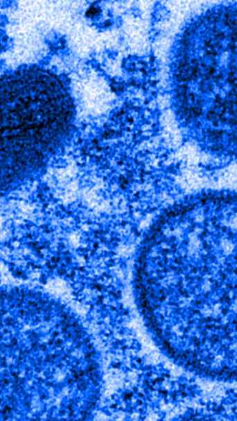 Micrographie électronique de particules de virus de la variole du singe isolés en 2003 aux États-Unis, dans des échantillons humains  // Source : The Conversation / Cynthia S. Goldsmith, Russell Regner / CDC / AP
