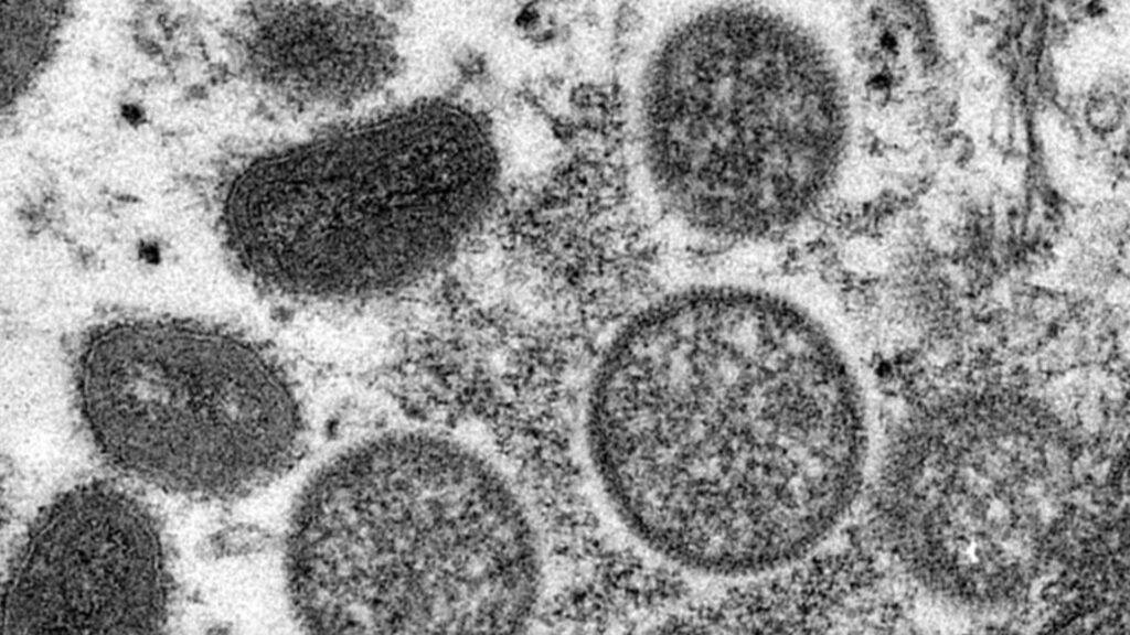 Micrographie électronique de particules de virus de la variole du singe isolés en 2003 aux États-Unis, dans des échantillons humains // Source : The Conversation / Cynthia S. Goldsmith, Russell Regner / CDC / AP
