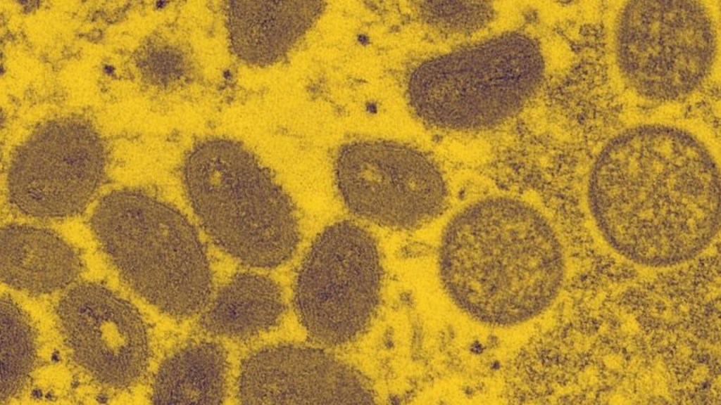 Variole du singe au microscope // Source : CDC