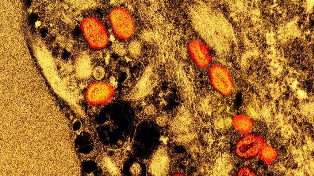 Le virus de la variole du singe // Source : Wikimedia Commons