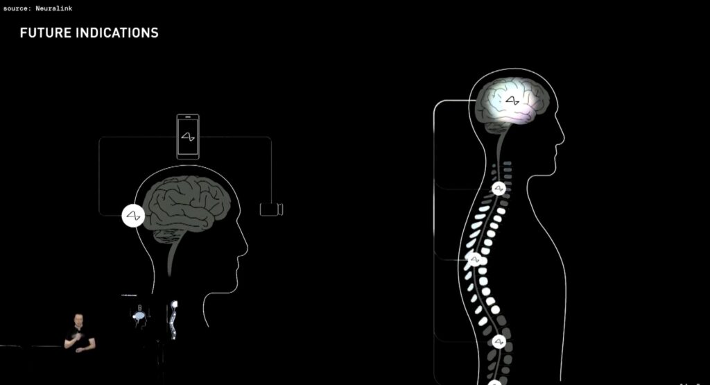 Deux priorités de Neuralink  // Source : YouTube/Neuralink/TheVerge