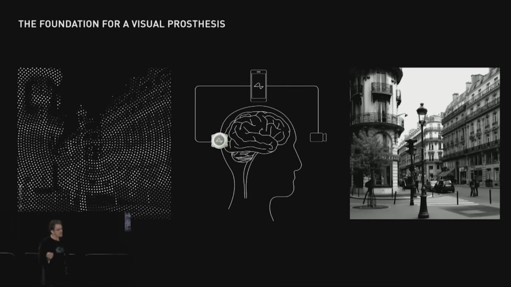 Schématisation du processus du neural lace pour la vision. // Source : Neuralink