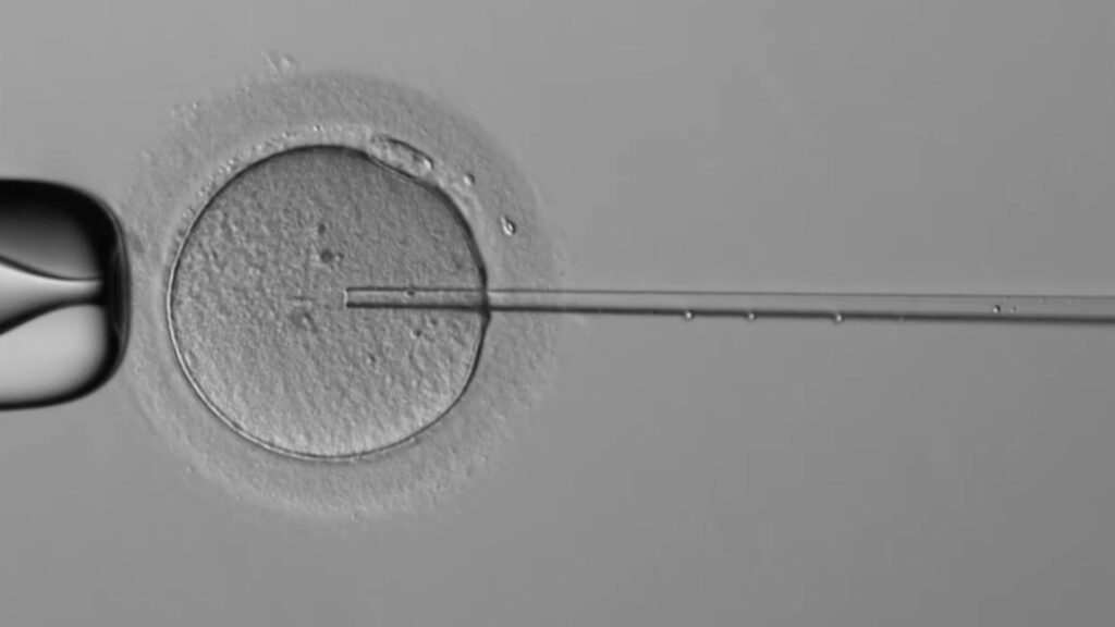 L'aiguille manipulée par le robot, dans l'ovule. // Source : Capture d'écran Overture