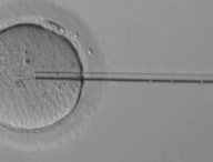 L'aiguille manipulée par le robot, dans l'ovule. // Source : Capture d'écran Overture
