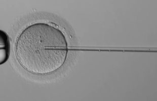 L'aiguille manipulée par le robot, dans l'ovule. // Source : Capture d'écran Overture