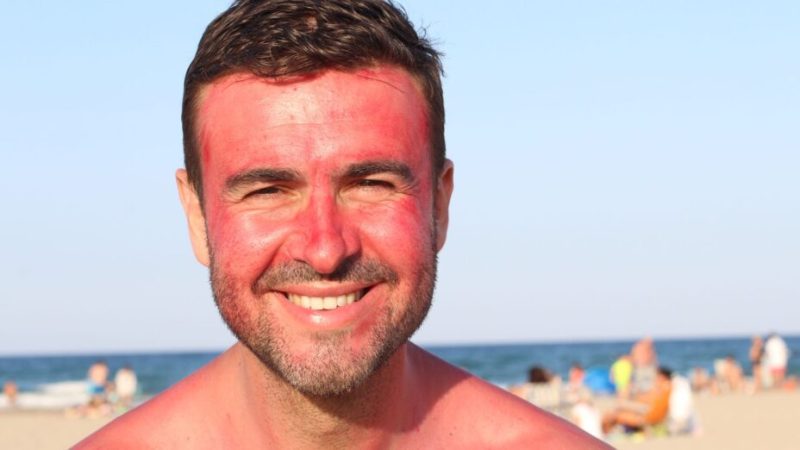 On peut prendre un coup de soleil à l’ombre, voici pourquoi