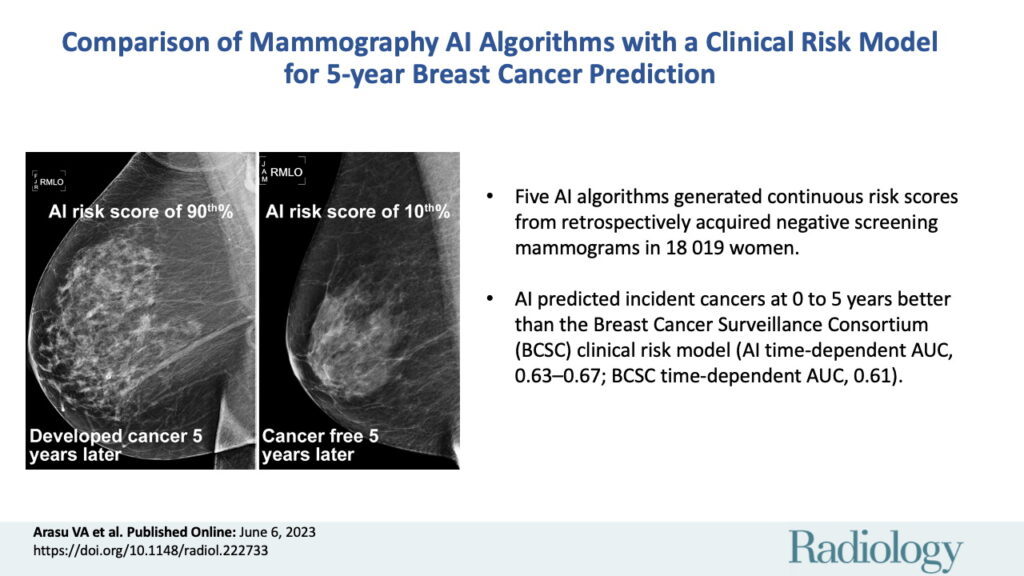 L'IA analyse les mammographies pour prédire s'il existe un risque de cancer du sein. // Source : Radiology