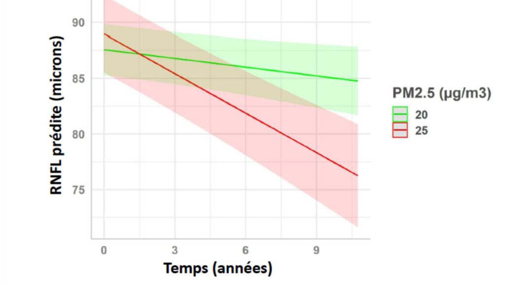 L'impact de la concentration en particules fines sur le vieillissement oculaire. // Source : Inserm/Université de Bordeaux