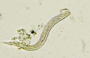 Pinworm // Source : Canva