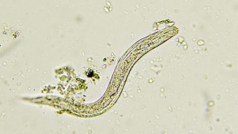 Comment ne pas être infecté par un ver parasite ?